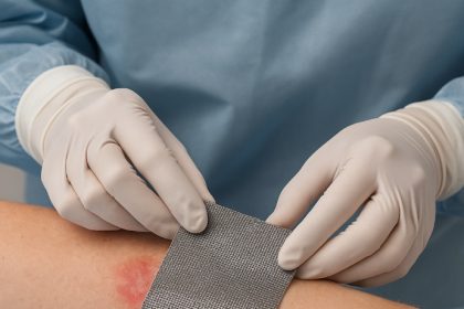 پانسمان نقره